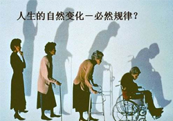 哪些人容易得骨質(zhì)疏松癥？骨質(zhì)疏松的高發(fā)人群有哪些？
