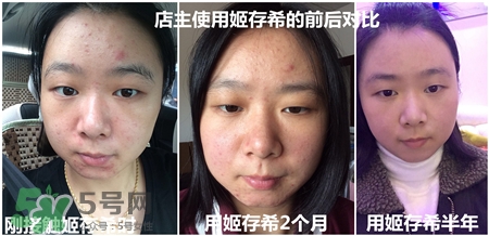 姬存希四件套里面有什么?姬存希美肌四件套怎么樣? 姬存希四件套里面有什么?姬存希美肌四件套怎么樣?