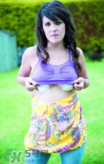 假體隆胸取出后圖片 隆胸假體取一月圖片 假體隆胸取出后圖片 隆胸假體取一月圖片