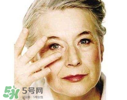 老年斑是怎么形成的？老年斑的形成原因