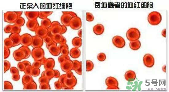 缺鐵性貧血的癥狀 缺鐵性貧血的癥狀有哪些？