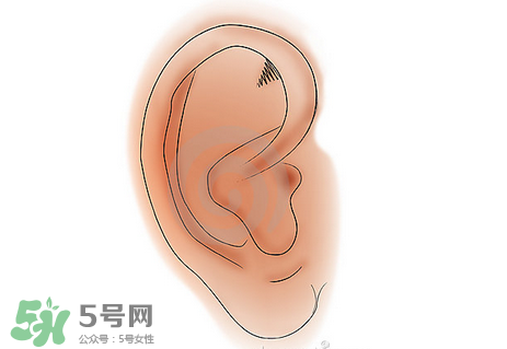 中耳炎有什么癥狀？中耳炎的癥狀表現(xiàn)