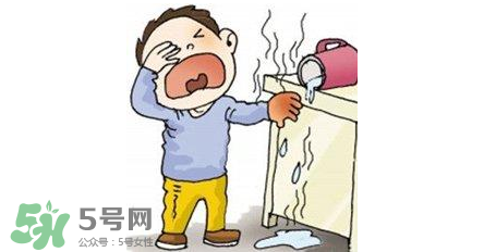 燙傷可以用牙膏嗎？燙傷用牙膏管用嗎？