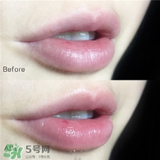 歐萊雅玻尿酸嘭嘭水怎么用?歐萊雅玻尿酸導(dǎo)入膨潤精華用法 歐萊雅玻尿酸嘭嘭水怎么用?歐萊雅玻尿酸導(dǎo)入膨潤精華用法