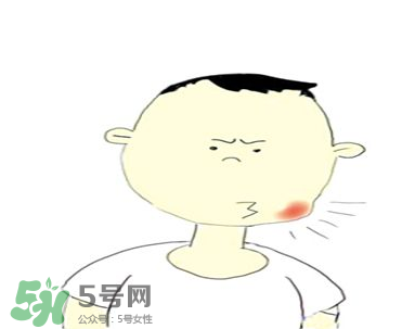 嘴角起泡是什么原因？嘴角起泡怎么辦？