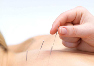 針灸可以治療風(fēng)濕嗎？針灸治風(fēng)濕性關(guān)節(jié)炎效果好嗎？