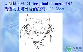 盆骨多大適合順產(chǎn) 盆骨多大可以順產(chǎn) 盆骨多大適合順產(chǎn) 盆骨多大可以順產(chǎn)