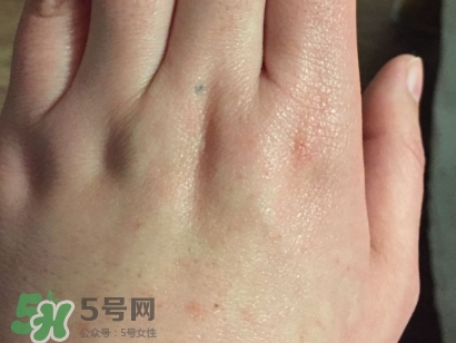 薇諾娜適合什么皮膚？薇諾娜適合敏感肌嗎？