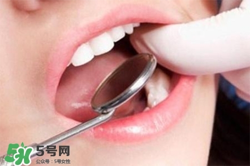 口腔異味是怎么回事？口腔異味怎么清除？