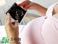 保胎期間可以洗澡嗎？臥床保胎可以洗澡嗎？