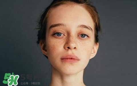 長(zhǎng)斑是什么原因引起的？祛斑效果最好的方法