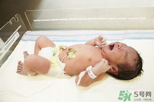 病理性黃疸孩子有何癥狀 病理性黃疸的特點(diǎn) 病理性黃疸孩子有何癥狀 病理性黃疸的特點(diǎn)