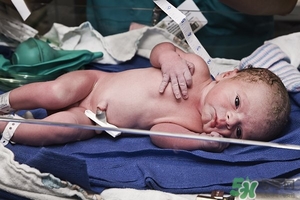 病理性黃疸孩子有何癥狀 病理性黃疸的特點(diǎn) 病理性黃疸孩子有何癥狀 病理性黃疸的特點(diǎn)