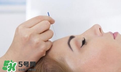 叢集性頭痛會死人嗎？叢集性頭痛的特點