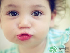 孕期可以激光祛斑嗎？懷孕了能做激光祛斑嗎？