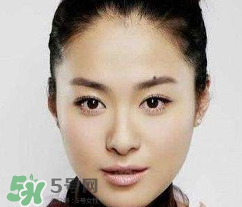 如何預防臉上長痣？怎樣預防臉上長痣