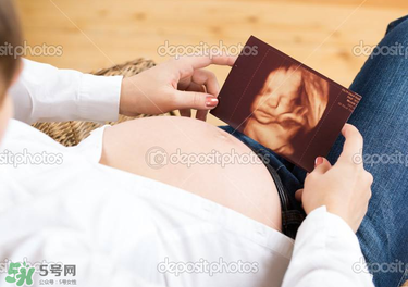 橄欖油真的可以預(yù)防妊娠紋嗎？橄欖油真的可以去妊娠紋嗎？