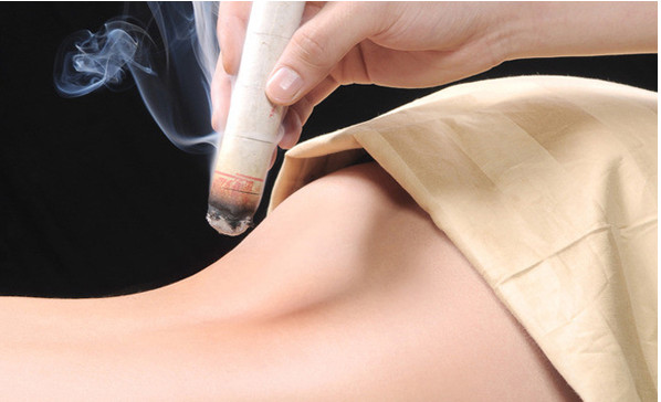 艾灸治療肩周炎有效嗎？艾灸治療肩周炎有沒有效