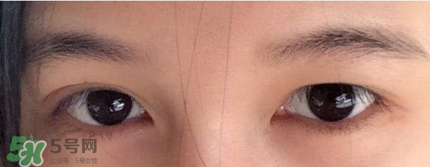 眼睛發(fā)黃是怎么回事？眼睛發(fā)黃是什么原因