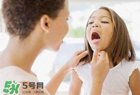 吃魚卡刺窒息死亡 喉嚨卡刺怎么辦小竅門 吃魚卡刺窒息死亡 喉嚨卡刺怎么辦小竅門