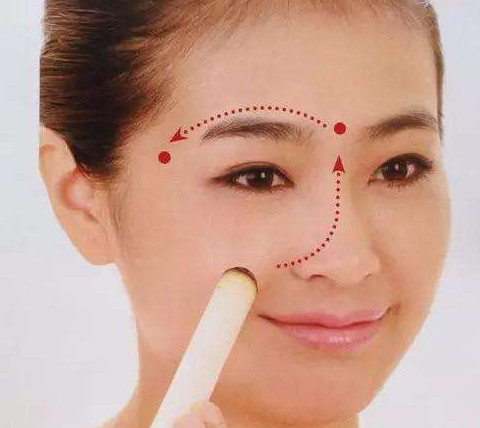 艾灸可以去黑眼圈嗎？艾灸可不可以去黑眼圈