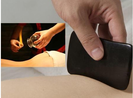 刮痧之后可以拔罐嗎？刮痧之后可不可以拔罐