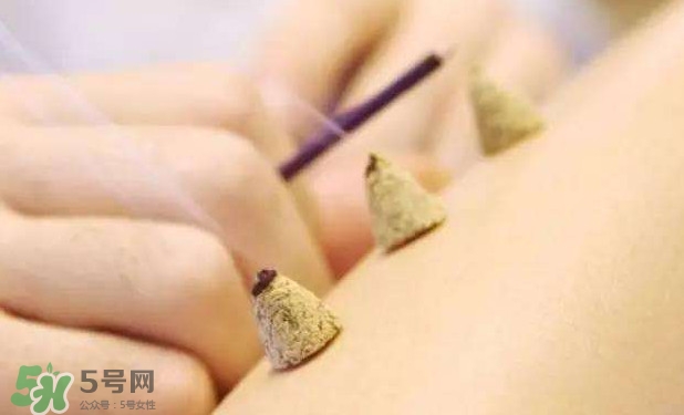 剛懷孕可以艾灸嗎？剛懷孕可以艾灸腹部嗎