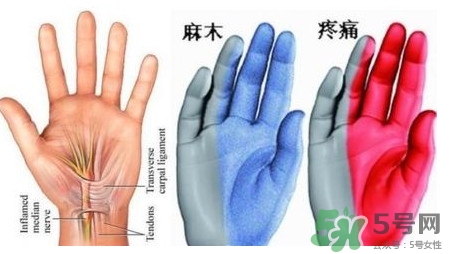 手腳發(fā)麻是缺鈣嗎？手腳發(fā)麻是不是缺鈣