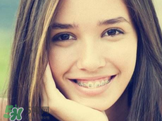 戴牙套可以接吻嗎?帶牙套會(huì)影響接吻嗎? 戴牙套可以接吻嗎?帶牙套會(huì)影響接吻嗎?