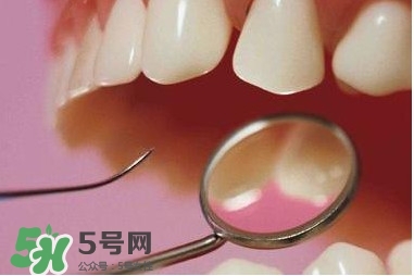 牙周炎傳染嗎？牙周炎會不會傳染