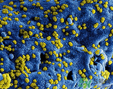 李斯特菌的感染癥狀?李斯特菌易感人群 李斯特菌的感染癥狀?李斯特菌易感人群