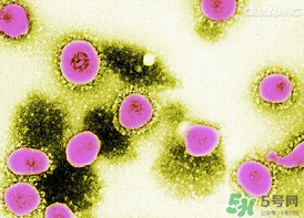 李斯特菌腦炎是什么病?李斯特菌腦炎能治好嗎? 李斯特菌腦炎是什么病?李斯特菌腦炎能治好嗎?