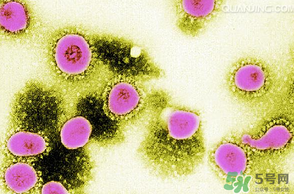 李斯特菌腦炎是什么病?李斯特菌腦炎能治好嗎? 李斯特菌腦炎是什么病?李斯特菌腦炎能治好嗎?