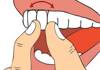 牙齒松動是腎虛嗎？牙齒松動腎陰虛還是陽虛