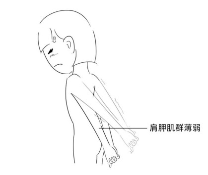 高低肩怎么糾正？高低肩的危害