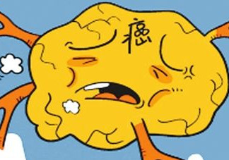 胃癌是怎么引起的？胃癌的早起癥狀