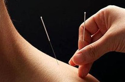 陰雨天能針灸嗎？陰雨天可以針灸嗎