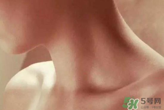 頸椎老化是什么??？頸椎老化的癥狀