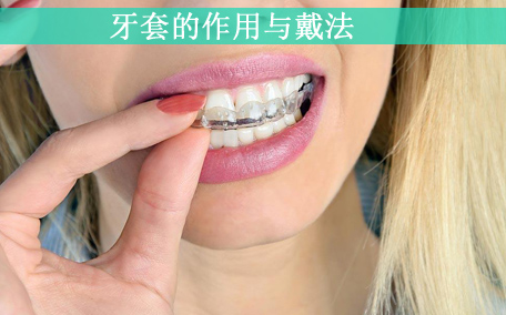 牙套的壽命是多少年 牙套的原理