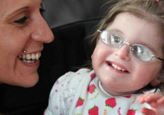 什么是早衰癥？早衰癥初期癥狀