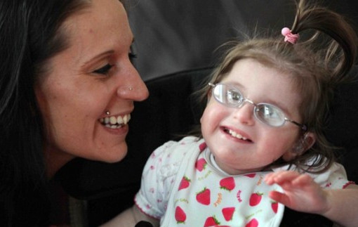 什么是早衰癥？早衰癥初期癥狀