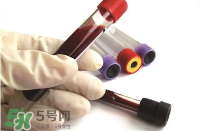 血脂稠吃什么食物好？血脂稠吃什么好