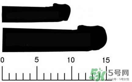 男人陰莖多長(zhǎng)正常？男人陰莖增長(zhǎng)的方法