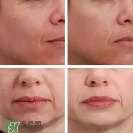 newa妞娃射頻美容儀多少錢?newa美容儀價格 newa妞娃射頻美容儀多少錢?newa美容儀價格