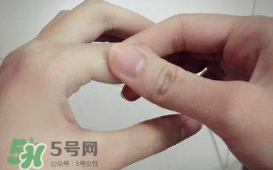 痛風(fēng)有什么癥狀？女性痛風(fēng)的初期癥狀