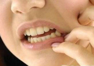 牙齒松動(dòng)怎么回事？牙齒松動(dòng)是什么原因呢