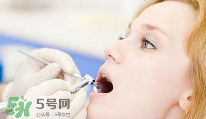 牙齒松動能自己恢復嗎？牙齒松動會自己恢復嗎