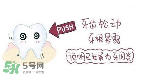 牙齒松動能自己恢復嗎？牙齒松動會自己恢復嗎