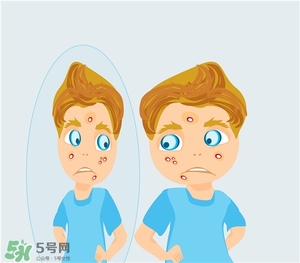 得了痤瘡飲食注意什么？有痤瘡吃東西注意什么