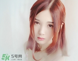 盆腔炎會(huì)影響生育嗎?盆腔炎會(huì)影響懷孕嗎? 盆腔炎會(huì)影響生育嗎?盆腔炎會(huì)影響懷孕嗎?